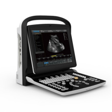 Ultrasonic Ultrasound Scanner Black White Doppler Laptop Portable (SC-ECO3)